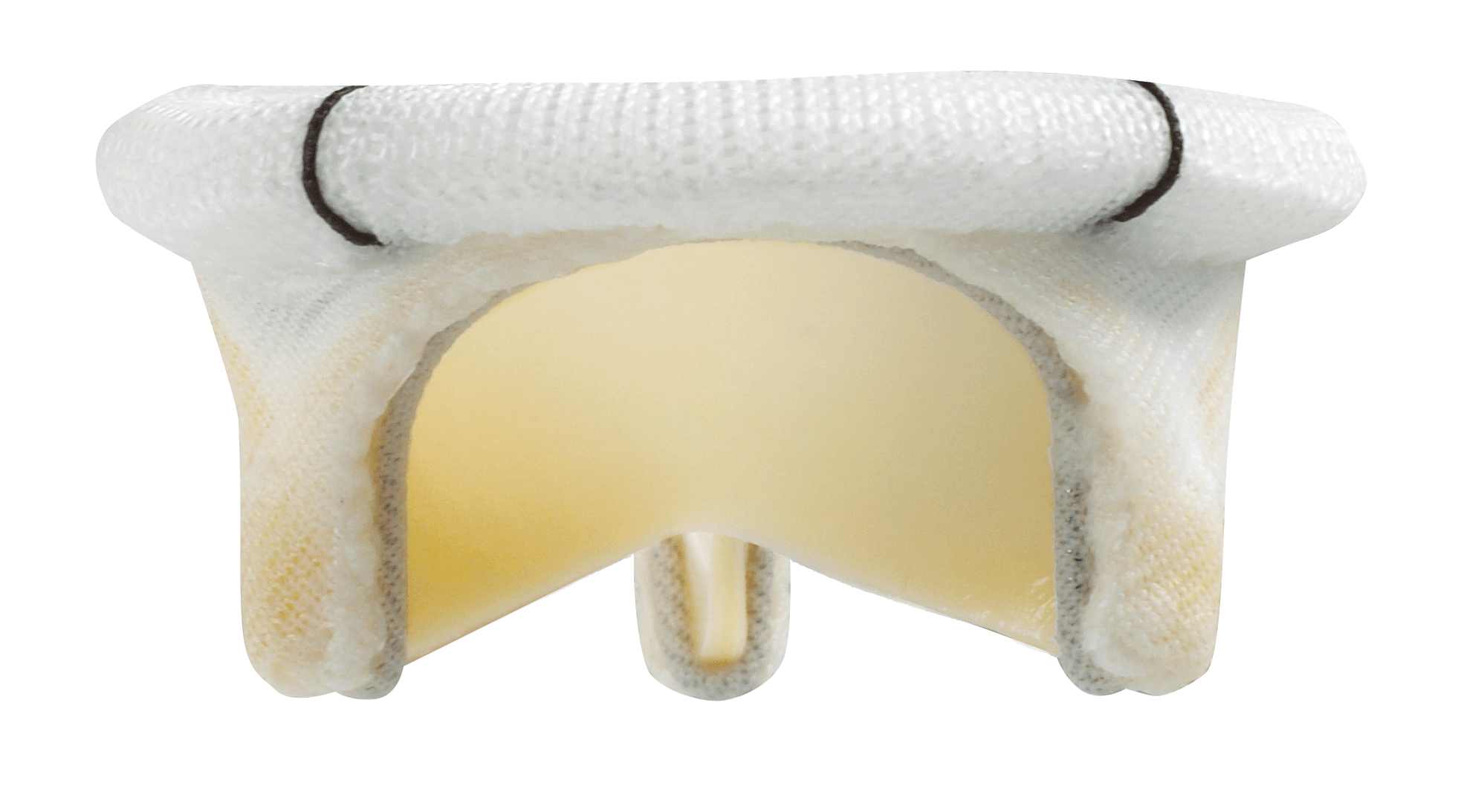 Mitral Pericardial Valve Edwards Lifesciences